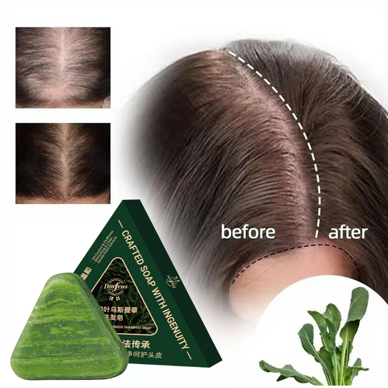 Anti-hair Loss Shampoo Bar! Wi - đánh giá và giá Bar Soap Shampoo Solid